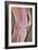 Osteoarthritic Knee X-ray-null-Framed Photographic Print