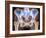 Osteoarthritis of Hip Joints, X-ray-Science Photo Library-Framed Photographic Print