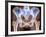 Osteoarthritis of Hip Joints, X-ray-Science Photo Library-Framed Photographic Print