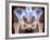 Osteoarthritis of Hip Joints, X-ray-Science Photo Library-Framed Photographic Print