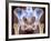 Osteoarthritis of Hip Joints, X-ray-Science Photo Library-Framed Photographic Print