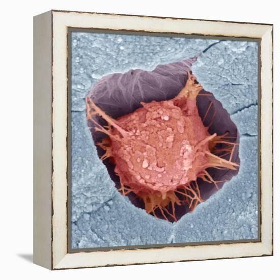 Osteoblast Bone Cell, SEM-Steve Gschmeissner-Framed Premier Image Canvas