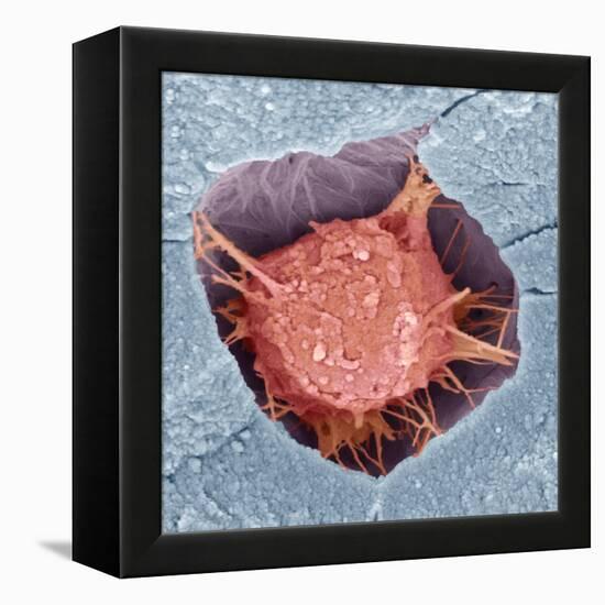 Osteoblast Bone Cell, SEM-Steve Gschmeissner-Framed Premier Image Canvas