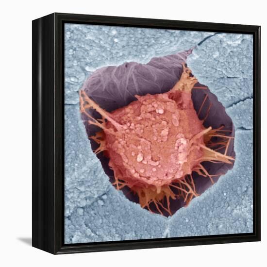 Osteoblast Bone Cell, SEM-Steve Gschmeissner-Framed Premier Image Canvas