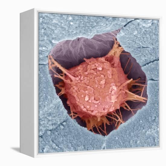 Osteoblast Bone Cell, SEM-Steve Gschmeissner-Framed Premier Image Canvas