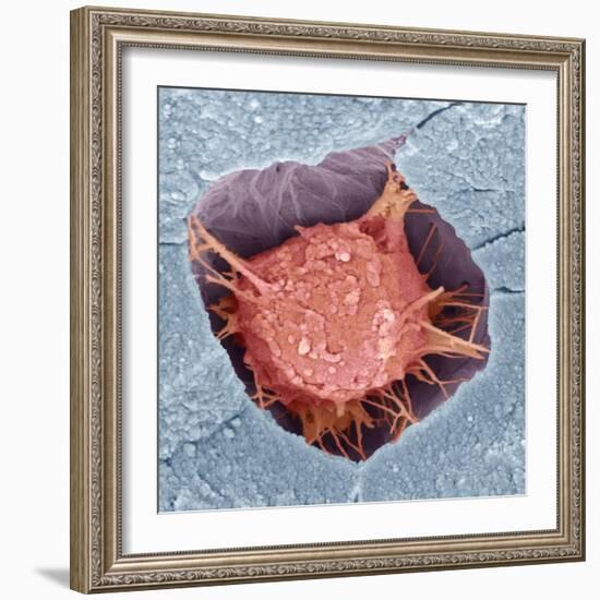Osteoblast Bone Cell, SEM-Steve Gschmeissner-Framed Premium Photographic Print