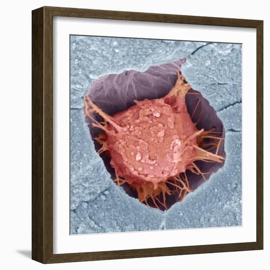 Osteoblast Bone Cell, SEM-Steve Gschmeissner-Framed Premium Photographic Print