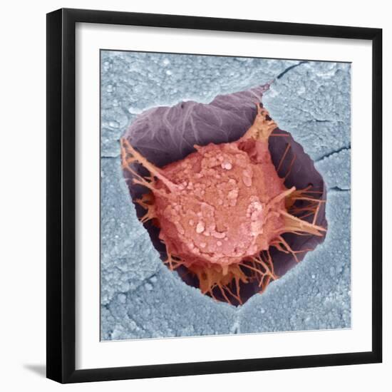 Osteoblast Bone Cell, SEM-Steve Gschmeissner-Framed Premium Photographic Print