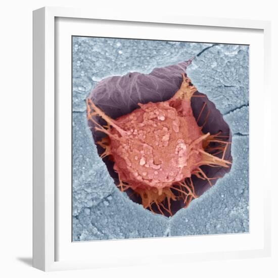 Osteoblast Bone Cell, SEM-Steve Gschmeissner-Framed Premium Photographic Print