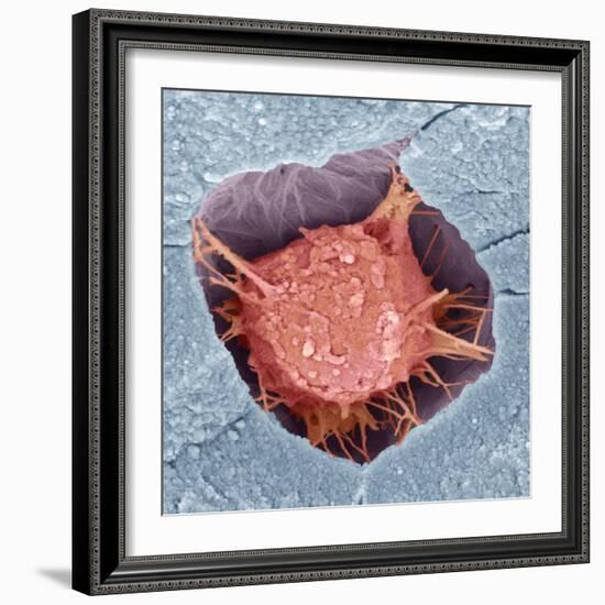 Osteoblast Bone Cell, SEM-Steve Gschmeissner-Framed Premium Photographic Print