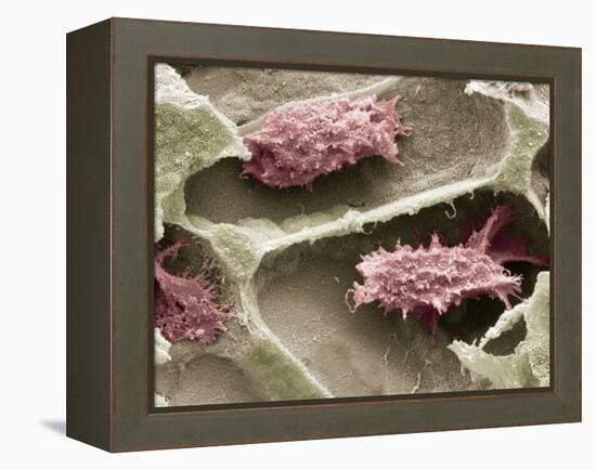 Osteoclasts In Bone Lacunae, SEM-Steve Gschmeissner-Framed Premier Image Canvas