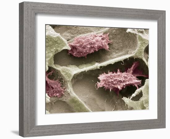 Osteoclasts In Bone Lacunae, SEM-Steve Gschmeissner-Framed Photographic Print