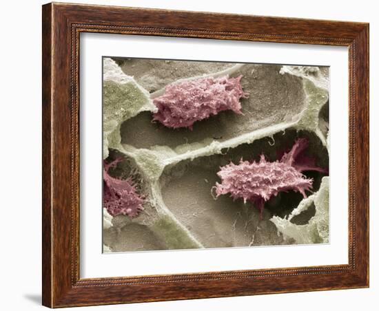 Osteoclasts In Bone Lacunae, SEM-Steve Gschmeissner-Framed Photographic Print