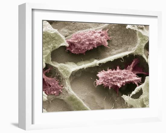 Osteoclasts In Bone Lacunae, SEM-Steve Gschmeissner-Framed Photographic Print