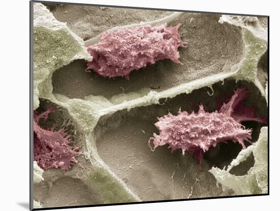 Osteoclasts In Bone Lacunae, SEM-Steve Gschmeissner-Mounted Photographic Print