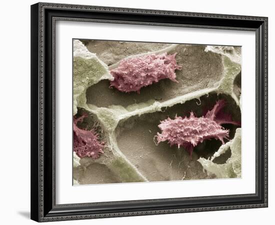 Osteoclasts In Bone Lacunae, SEM-Steve Gschmeissner-Framed Photographic Print