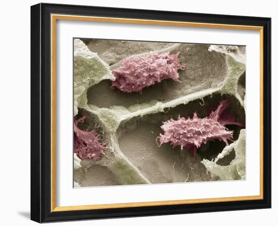 Osteoclasts In Bone Lacunae, SEM-Steve Gschmeissner-Framed Photographic Print