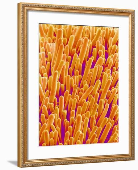 Outer Cells on Petal of Cymbidium Plant-Micro Discovery-Framed Photographic Print