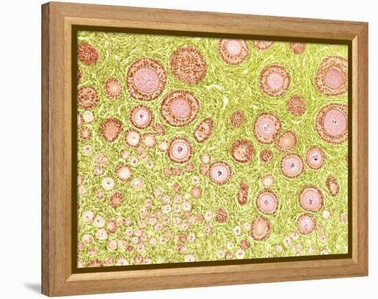 Ovarian Follicles, Light Micrograph-Steve Gschmeissner-Framed Premier Image Canvas