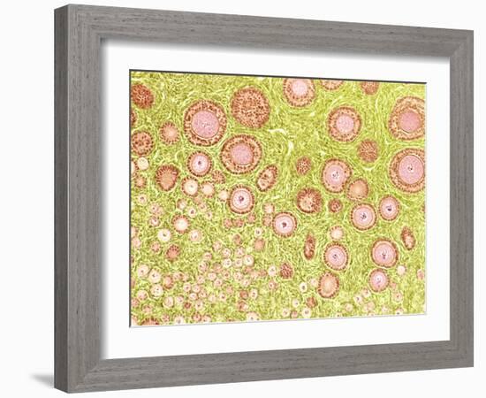 Ovarian Follicles, Light Micrograph-Steve Gschmeissner-Framed Photographic Print