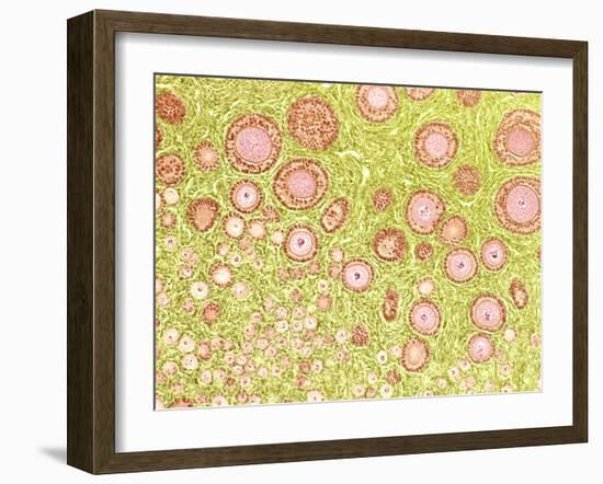 Ovarian Follicles, Light Micrograph-Steve Gschmeissner-Framed Photographic Print