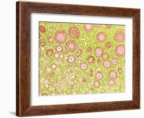 Ovarian Follicles, Light Micrograph-Steve Gschmeissner-Framed Photographic Print