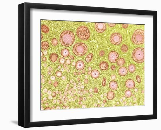 Ovarian Follicles, Light Micrograph-Steve Gschmeissner-Framed Photographic Print