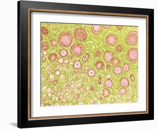 Ovarian Follicles, Light Micrograph-Steve Gschmeissner-Framed Photographic Print