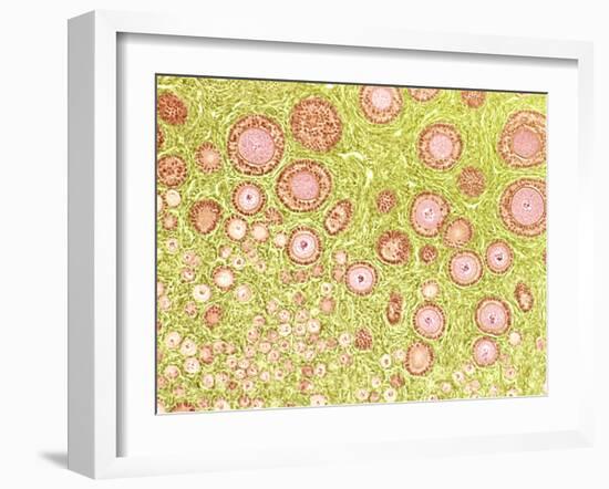 Ovarian Follicles, Light Micrograph-Steve Gschmeissner-Framed Photographic Print