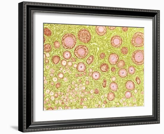 Ovarian Follicles, Light Micrograph-Steve Gschmeissner-Framed Photographic Print