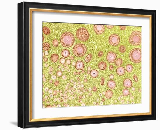 Ovarian Follicles, Light Micrograph-Steve Gschmeissner-Framed Photographic Print