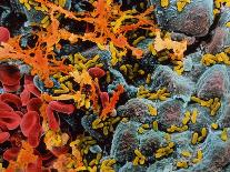 Coloured SEM of Giardia Lamblia In Human Intestine-P.m. Motta-Photographic Print
