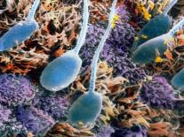 Coloured SEM of Giardia Lamblia In Human Intestine-P.m. Motta-Premier Image Canvas