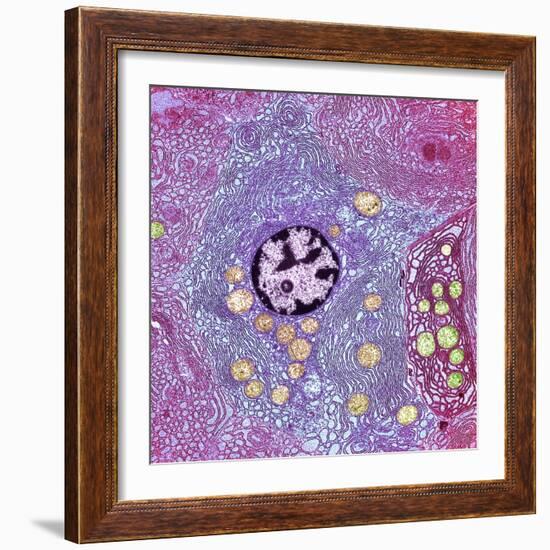 Pancreas Cell, TEM-Steve Gschmeissner-Framed Premium Photographic Print