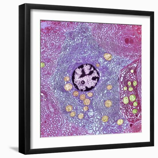 Pancreas Cell, TEM-Steve Gschmeissner-Framed Premium Photographic Print