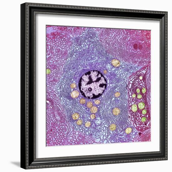 Pancreas Cell, TEM-Steve Gschmeissner-Framed Premium Photographic Print