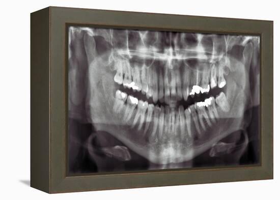 Panoramic Dental X-ray-null-Framed Premier Image Canvas