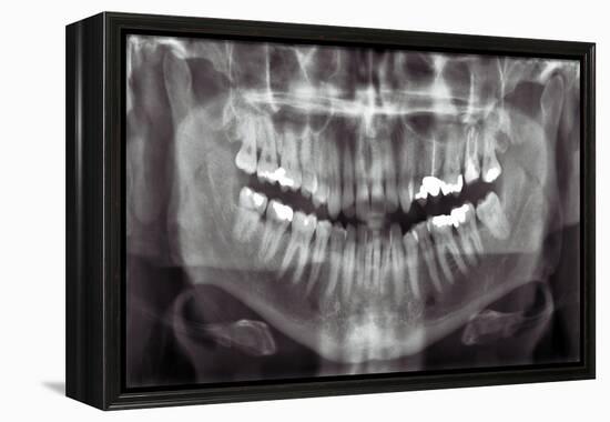 Panoramic Dental X-ray-null-Framed Premier Image Canvas