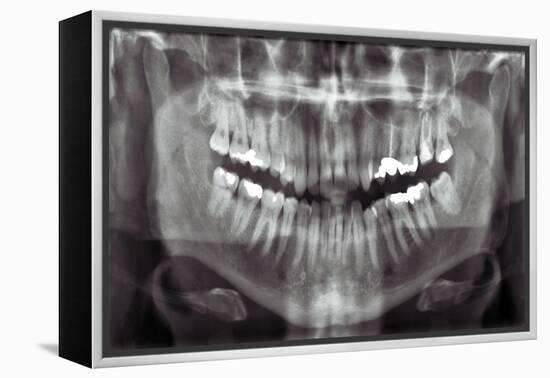 Panoramic Dental X-ray-null-Framed Premier Image Canvas