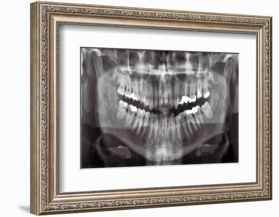 Panoramic Dental X-ray-null-Framed Photographic Print