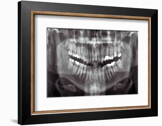 Panoramic Dental X-ray-null-Framed Photographic Print