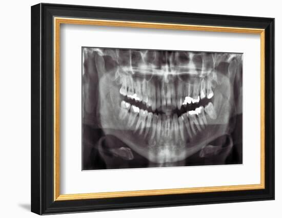 Panoramic Dental X-ray-null-Framed Photographic Print