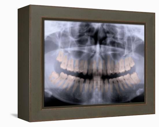 Panoramic X-Ray of Mouth-null-Framed Premier Image Canvas