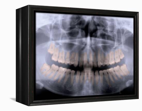Panoramic X-Ray of Mouth-null-Framed Premier Image Canvas