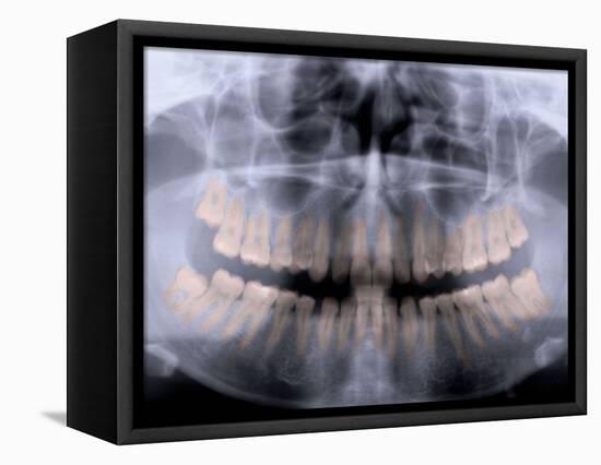 Panoramic X-Ray of Mouth-null-Framed Premier Image Canvas