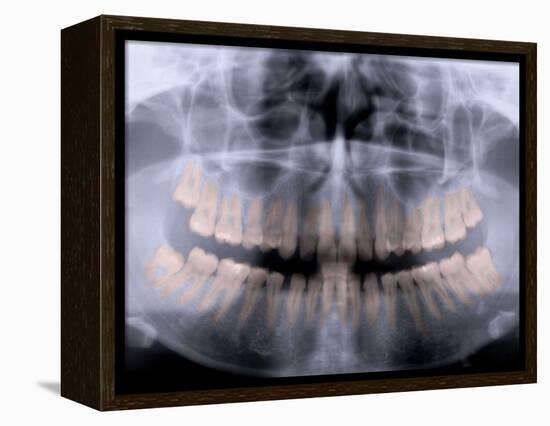 Panoramic X-Ray of Mouth-null-Framed Premier Image Canvas