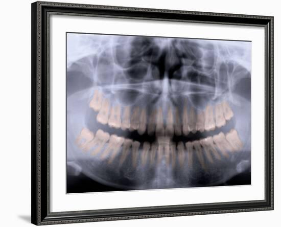 Panoramic X-Ray of Mouth-null-Framed Photographic Print