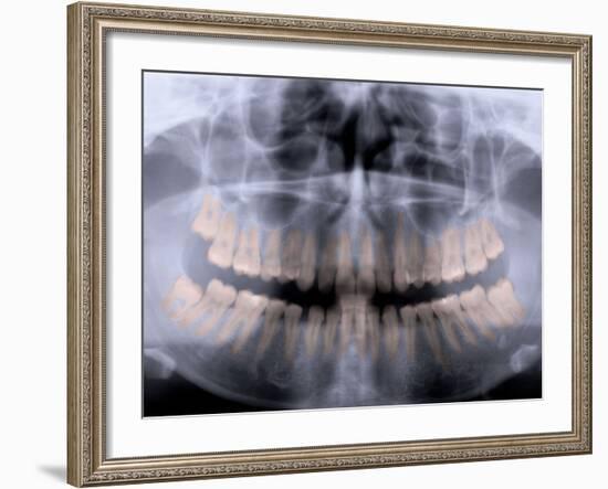 Panoramic X-Ray of Mouth-null-Framed Photographic Print