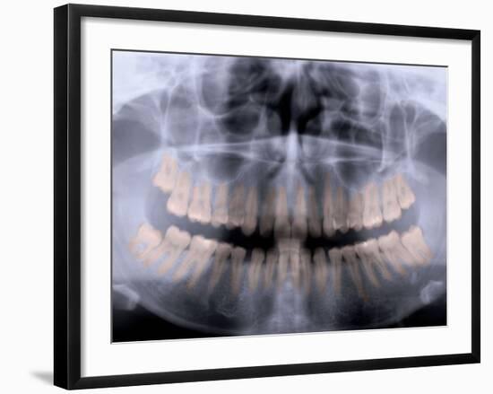 Panoramic X-Ray of Mouth-null-Framed Photographic Print