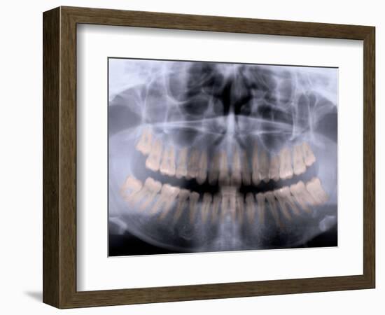 Panoramic X-Ray of Mouth-null-Framed Photographic Print